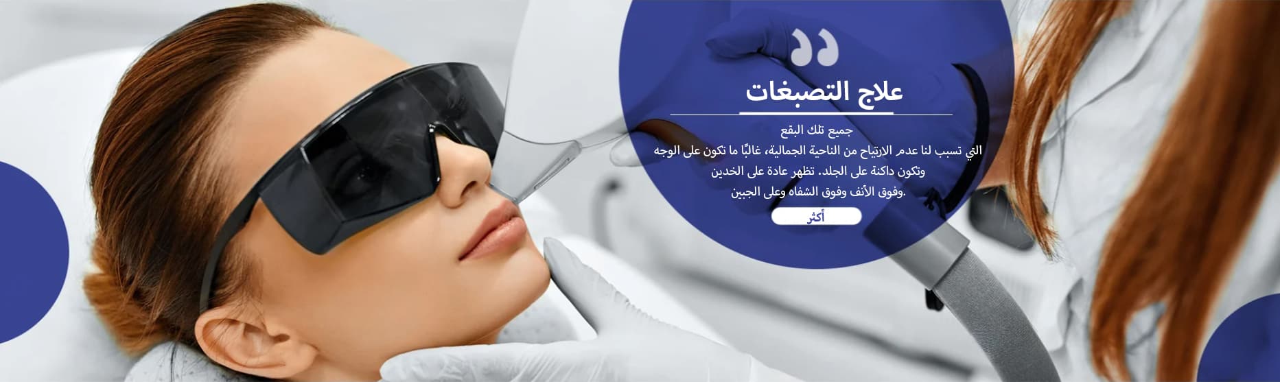 علاج البقع الجلدية