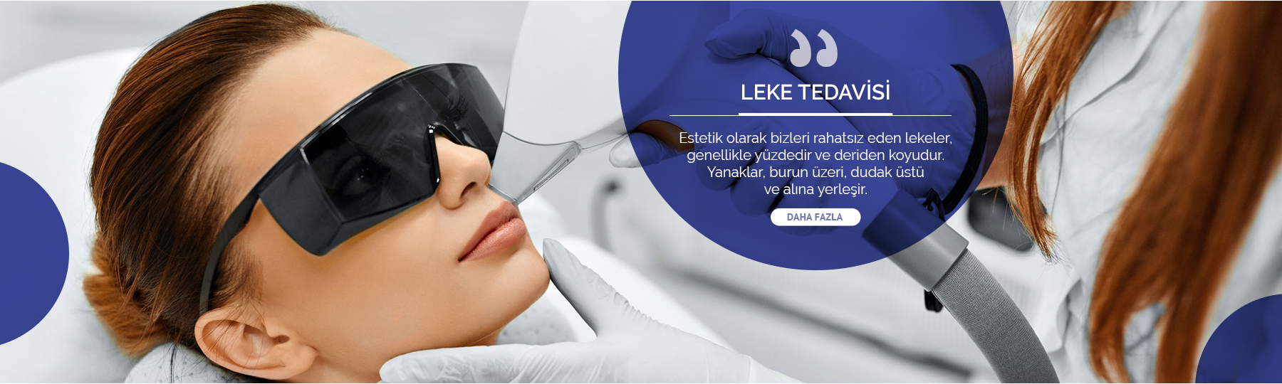 Leke Tedavisi