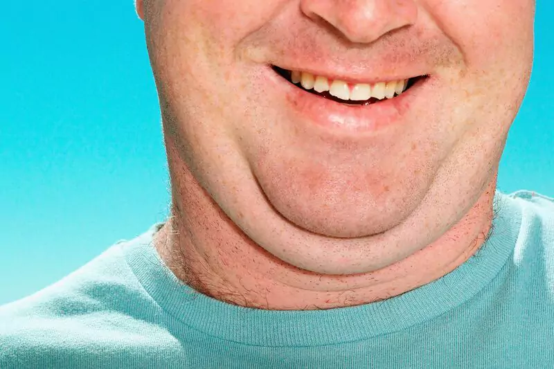 ameliyatsız gıdı eritme