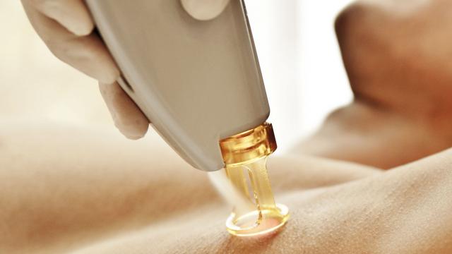 elektroliz epilasyon